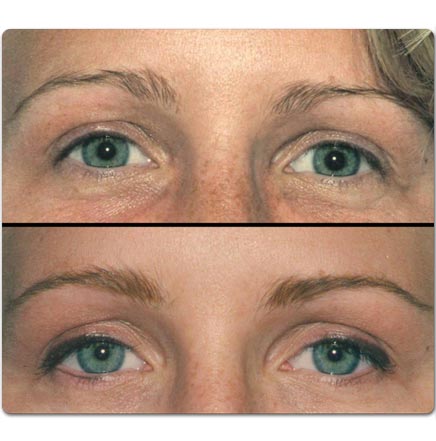 eyebrows before and after